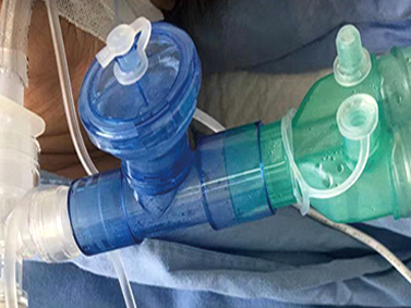 Portable sputum aspirator